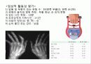 류마티스관절염 17페이지