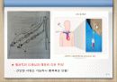AKR 인공신장실 Dialysis (hemodialysis) PPT 잘료 16페이지