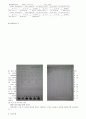 Lt. distal tibia & fibular Fx 16페이지