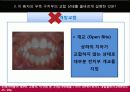치위생 증례 4페이지