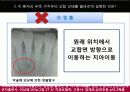 치위생 증례 8페이지