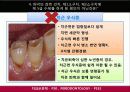 치위생 증례 12페이지
