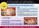 치위생 증례 15페이지