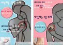티저광고 - Teaser teases us??? (넌 먹니??? 난  붙여.) 30페이지