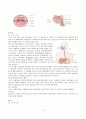 상부 위장관 출혈(UGI Bleeding) 케이스 스터디 4페이지