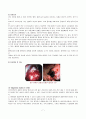 상부 위장관 출혈(UGI Bleeding) 케이스 스터디 8페이지