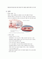 cva 뇌졸증 레포트 3페이지
