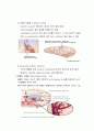 cva 뇌졸증 레포트 4페이지