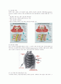 crps(복합성 부위 통증증후군) 레포트 3페이지