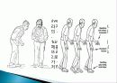 정상보행과 이상보행 38페이지
