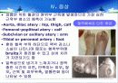 말초동맥질환 12페이지