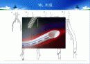 말초동맥질환 35페이지