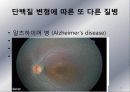 광우병 발표 PPT자료 21페이지