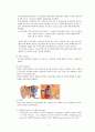 중이염과 유양돌기절제수술 5페이지