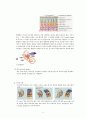 중이염과 유양돌기절제수술 6페이지