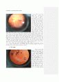 [생물화학실험] 코아세르베이트(Coacervate) 관찰 (The Observation of the Coacervate) 3페이지