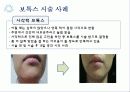 보톡스의 허와 실 19페이지