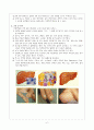 간경화(Liver Cirrhosis), 정맥류성 정맥(Varicose veins), 간세포암(Hepatocellular carcinoma)  2페이지