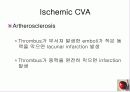 정의,위험요소,유형,자연경과,합병증 13페이지