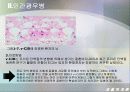 [생물학개론] 광우병관련 mcd (Mad Cow Disease) 12페이지
