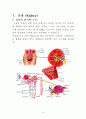 혈액투석(Hemodialysis) 1페이지