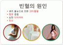 빈혈(anemia) 5페이지