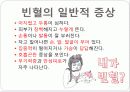 빈혈(anemia) 7페이지