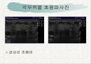 [의료] Ultra Sound - 초음파검사 12페이지