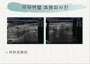[의료] Ultra Sound - 초음파검사 13페이지