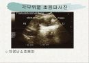 [의료] Ultra Sound - 초음파검사 14페이지