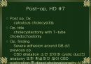 담낭염(cholecystitis)케이스 13페이지