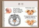 파킨슨병 (PARKINSON’S DISEASE) 4페이지