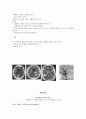 뇌졸중 CASE STUDY 16P 3페이지