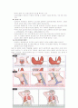 CASE STDUY-갑상선암 8페이지