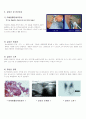 Case Study(갑상선암) 5페이지