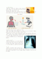 케이스 스터디(Case Study) - 폐렴(pneumonia, ICP) 6페이지