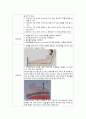 케이스 스터디(Case Study) - 폐렴(pneumonia, ICP) 21페이지