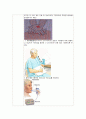 케이스 스터디(Case Study) - 폐렴(pneumonia, ICP) 22페이지