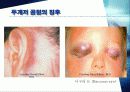 ATLS : Advanced Trauma Life Support (전문 외상 처치술) 66페이지
