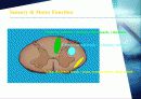 ATLS : Advanced Trauma Life Support (전문 외상 처치술) 88페이지