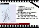 BPB (Brachial Plexus Block) 15페이지