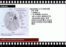 BPB (Brachial Plexus Block) 17페이지