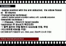 BPB (Brachial Plexus Block) 19페이지