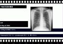 BPB (Brachial Plexus Block) 21페이지