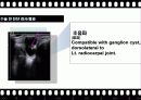 BPB (Brachial Plexus Block) 22페이지