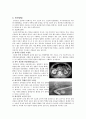 케이스스터디(총담관결석증) 4페이지