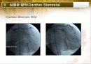 Angiography(혈관조영검사) 14페이지