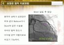 Angiography(혈관조영검사) 17페이지