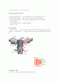자궁_절제술(hystrectomy) 2페이지