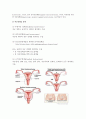 자궁_절제술(hystrectomy) 4페이지